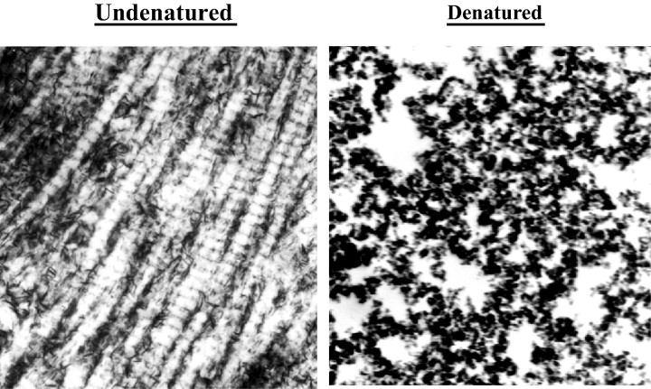 Collagen type II không biến tính